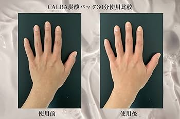 Amazon.co.jp: CALBA カルバ 炭酸パック ヒト幹細胞 培養液 高濃度